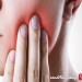 Image of درمان طبیعی دندان درد | اینفوسلامت